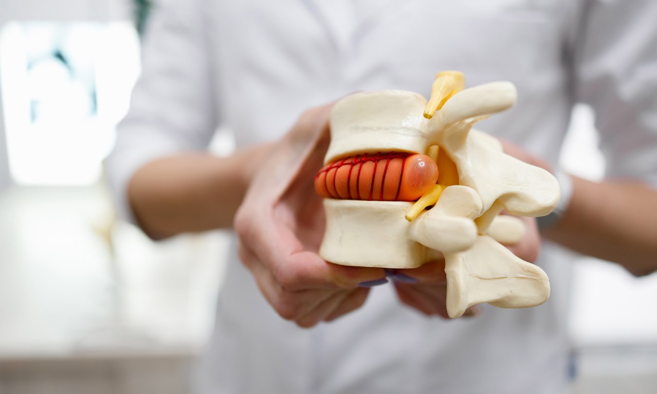 Afyon Ameliyatsız Bel Fıtığı Tedavisi: Modern ve Etkili Çözüm